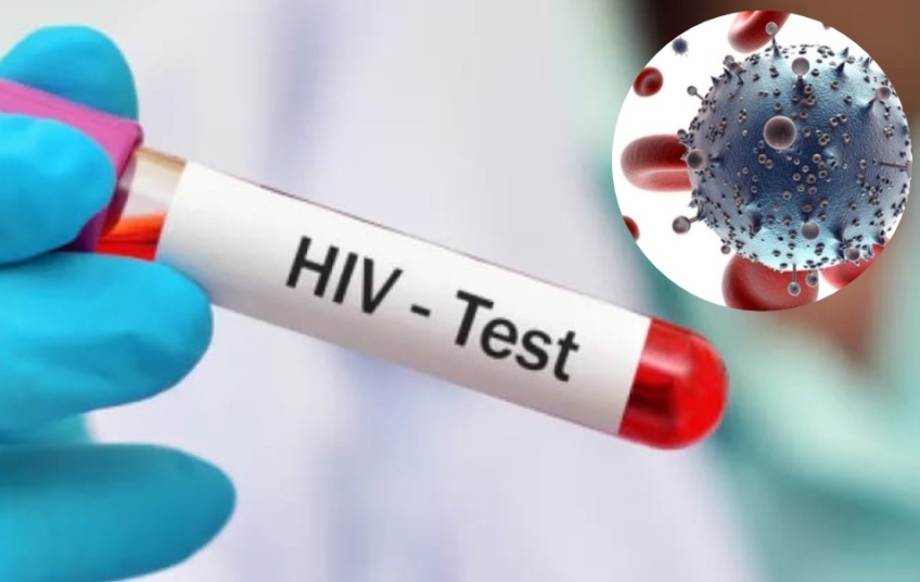 Un trasplante de células madre logra un nuevo caso de curación del VIH y suma ya diez pacientes